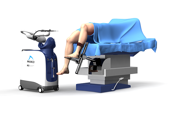 MAKO Rio Robotic Arm - Robotic Surgery